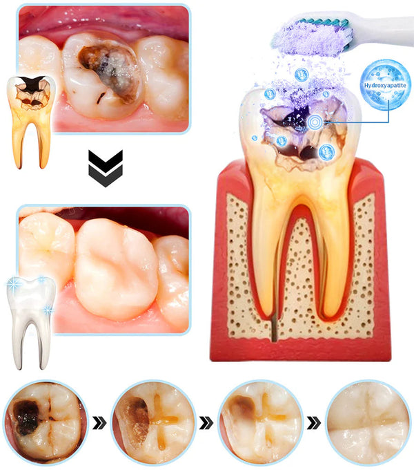 1 + 1 GRATIS HEUTE  DentiGlow™