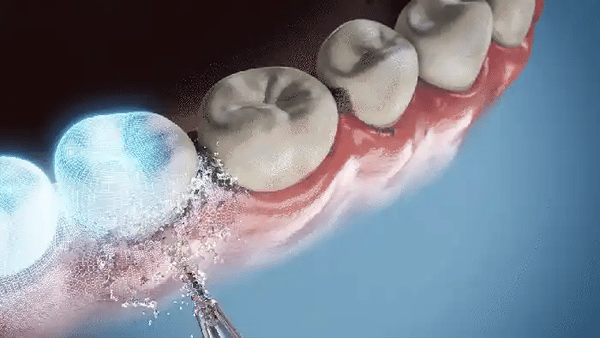 50% OFF TEMPORÄR  HydroFloss™